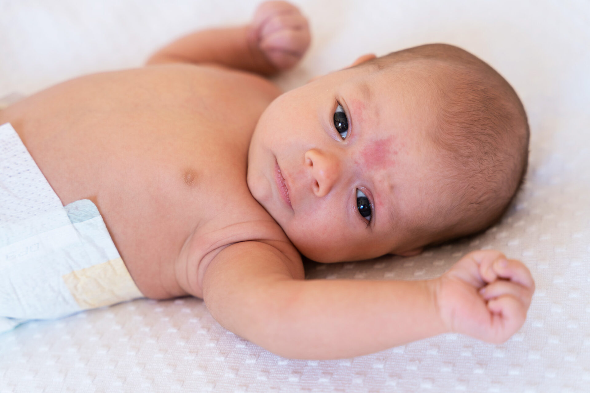 Niemowlę podczas rozszerzania diety. Jak odróżnić alergię pokarmową, wyprysk kontaktowy i AZS u dziecka.